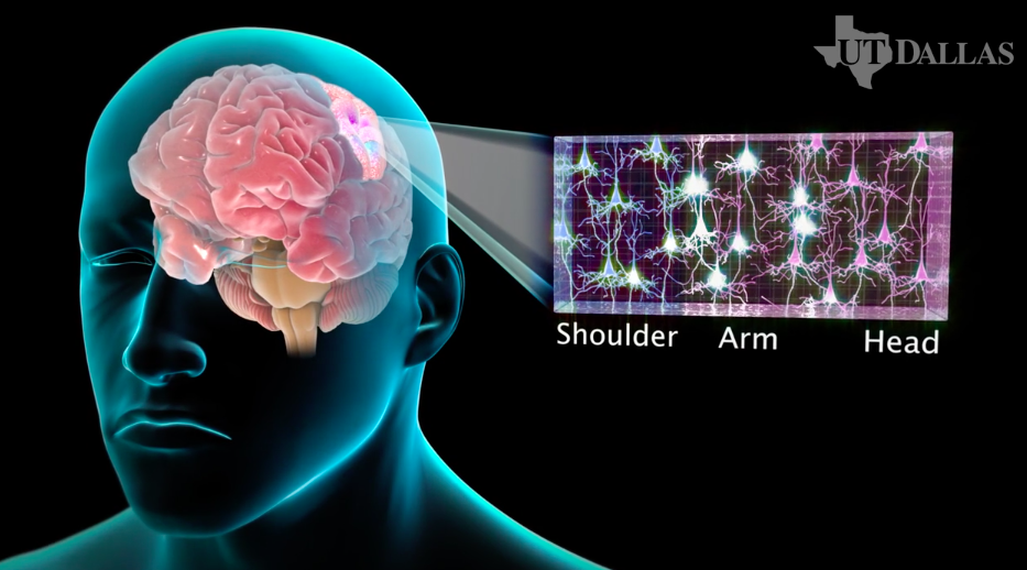How Neurostim Helps Stroke Rehab, Creates Soldiers of the Future [Q&A]